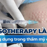 Tiêm meso phục hồi da và những lợi ích bất ngờ cho làn da mỏng yếu 3 Mesotherapy là gì và ứng dụng trong thẩm mỹ da liễu