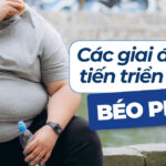 Vì sao nên điều trị béo phì càng sớm càng tốt? 2 Các giai đoạn tiến triển của béo phì