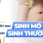 7 bài tập giảm cân dành cho phụ nữ sau sinh mổ 2 Giảm cân sau sinh mổ có khó hơn sinh thường?