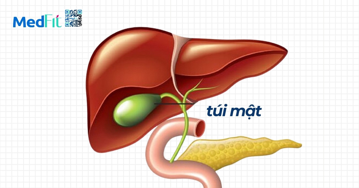 Nguy cơ sỏi mật khi giảm cân quá nhanh 1 hình minh họa túi mật