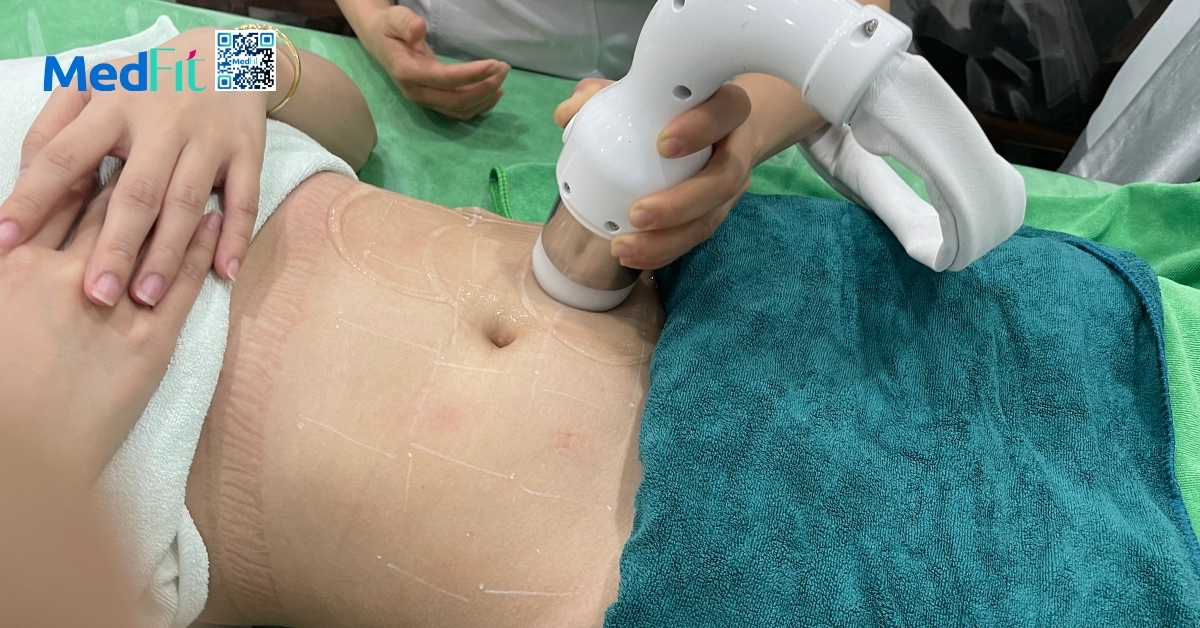 làm cfu body tại medfit