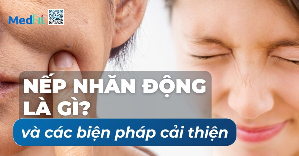 nếp nhăn động là gì và các biện pháp cải thiện
