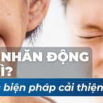 Nếp nhăn động là gì và các biện pháp cải thiện