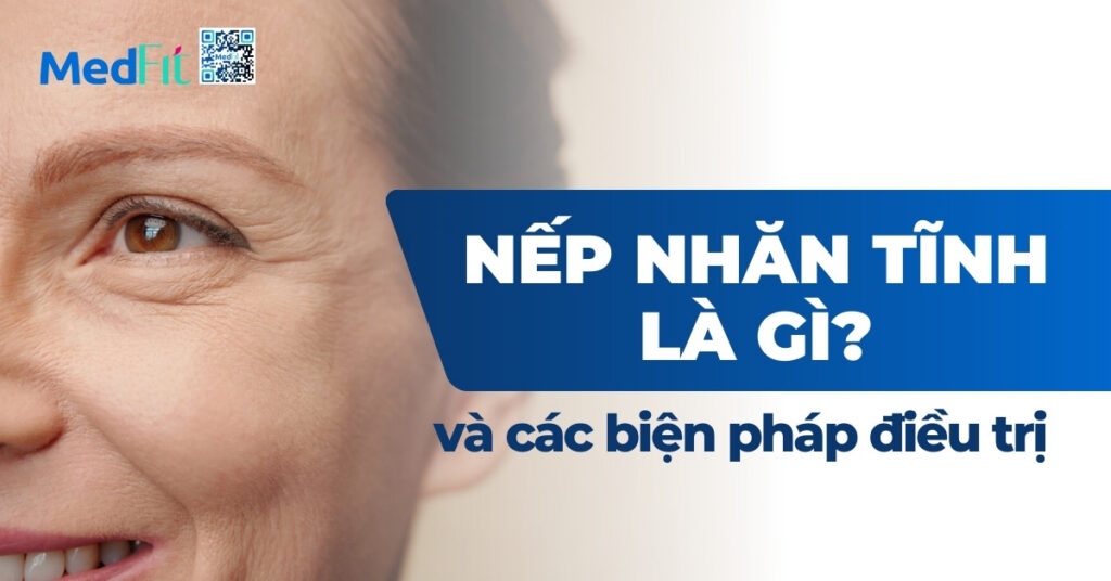 nếp nhăn tĩnh là gì và các biện pháp điều trị