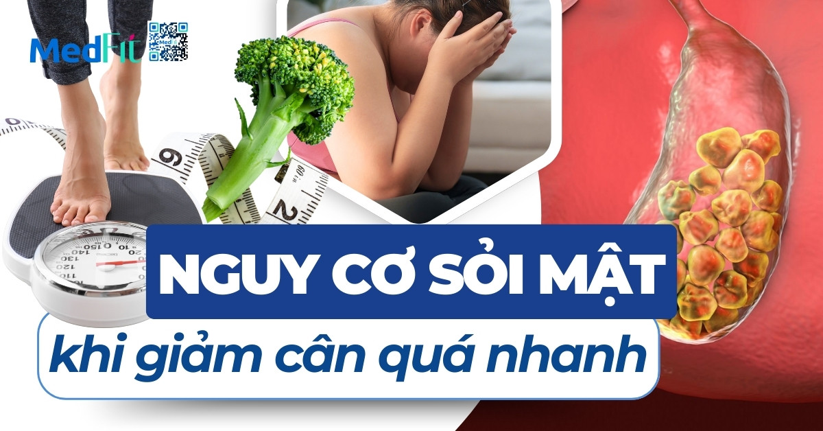 nguy cơ sỏi mật khi giảm cân quá nhanh