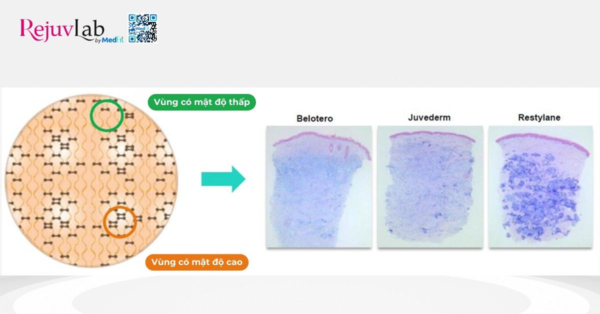 so sánh độ kết dính của belotero, juvederm và restylane