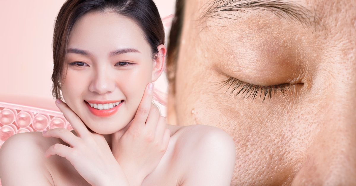 Lỗ chân lông thu nhỏ