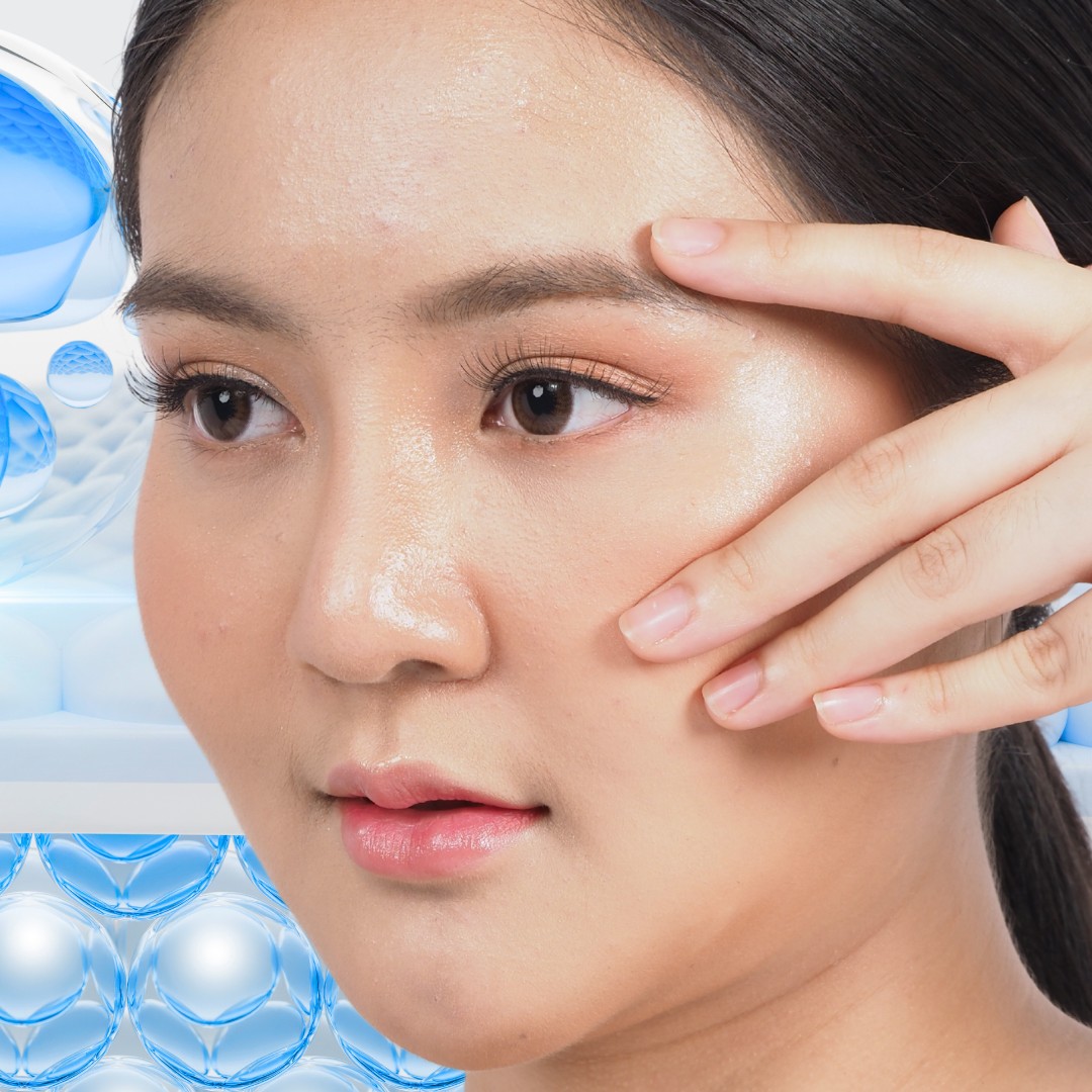 Nâng toàn diện các mô chảy xệ
