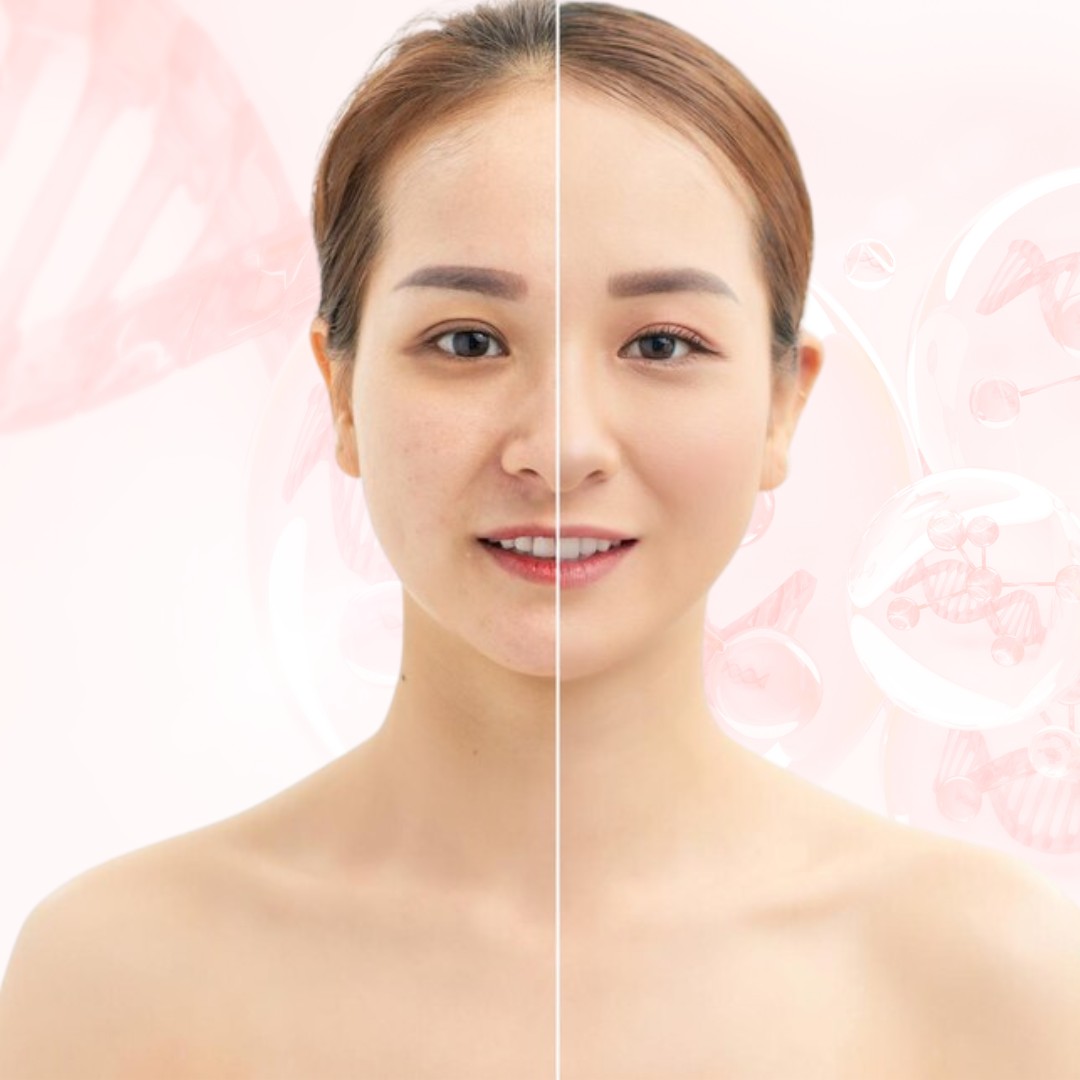 Phục hồi và trẻ hóa