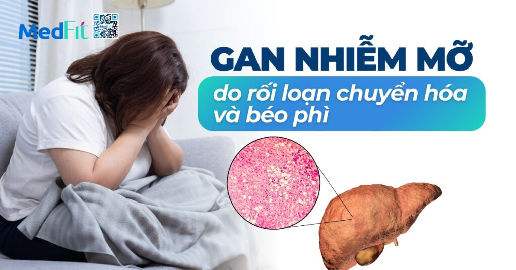 gan nhiễm mỡ do rối loạn chuyển hóa và béo phì