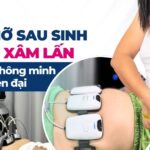 Giảm mỡ sau sinh không xâm lấn – Lựa chọn thông minh cho mẹ hiện đại