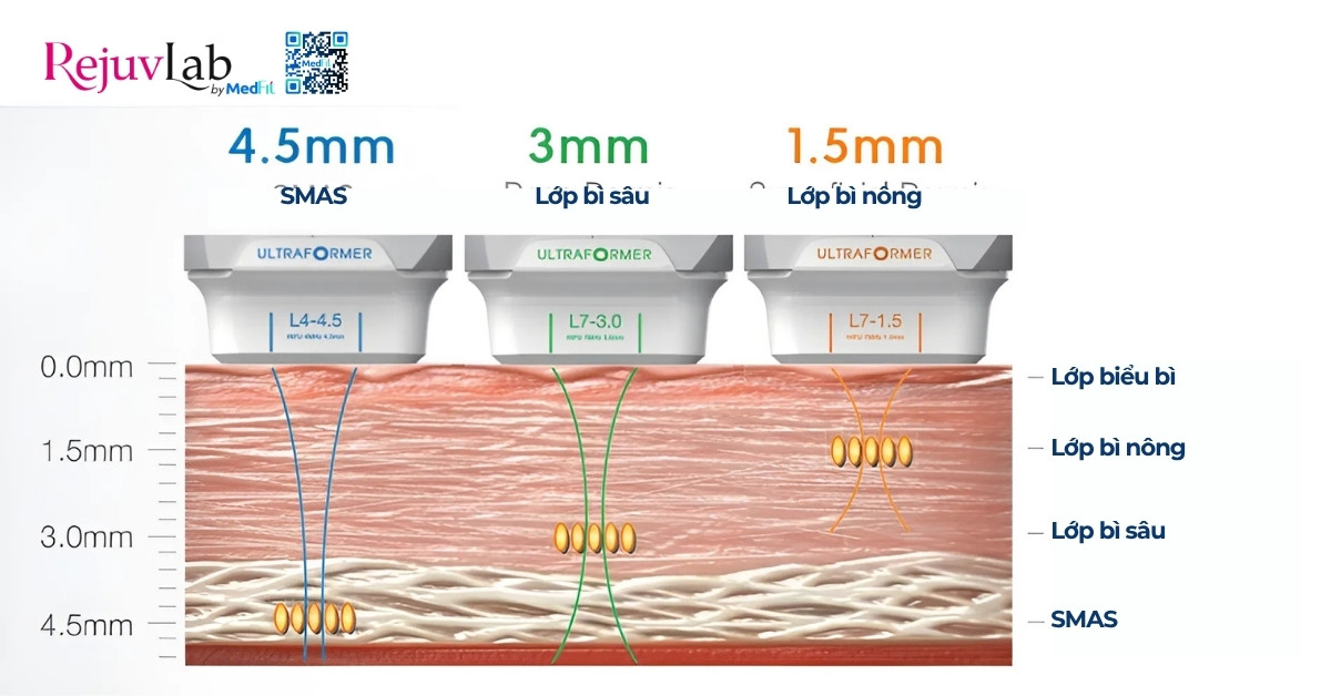 hifu tác động sâu vào các lớp dưới da