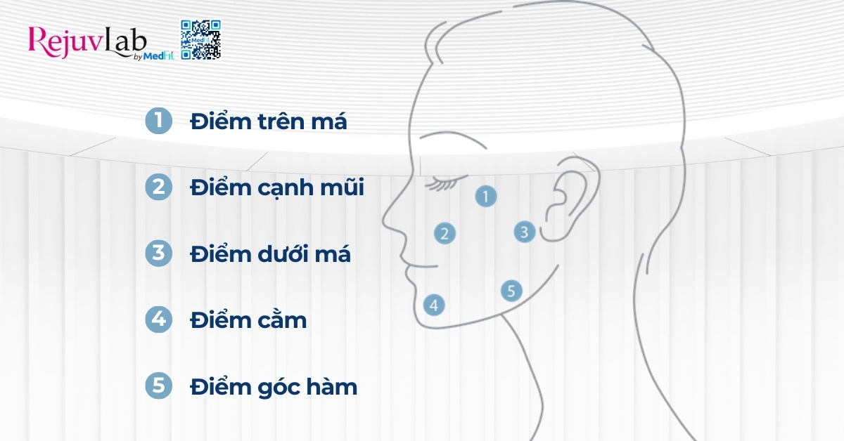 hình minh họa 5 điểm tiêm bap