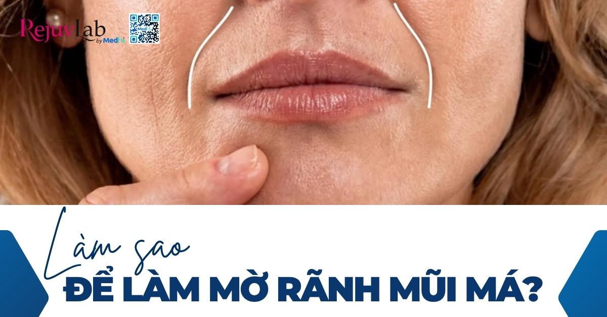 làm sao để làm mờ rãnh mũi má