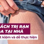 Trị rạn da sau sinh bằng laser liệu có hiệu quả? 7 5 cách trị rạn da tại nhà tiết kiệm và dễ thực hiện