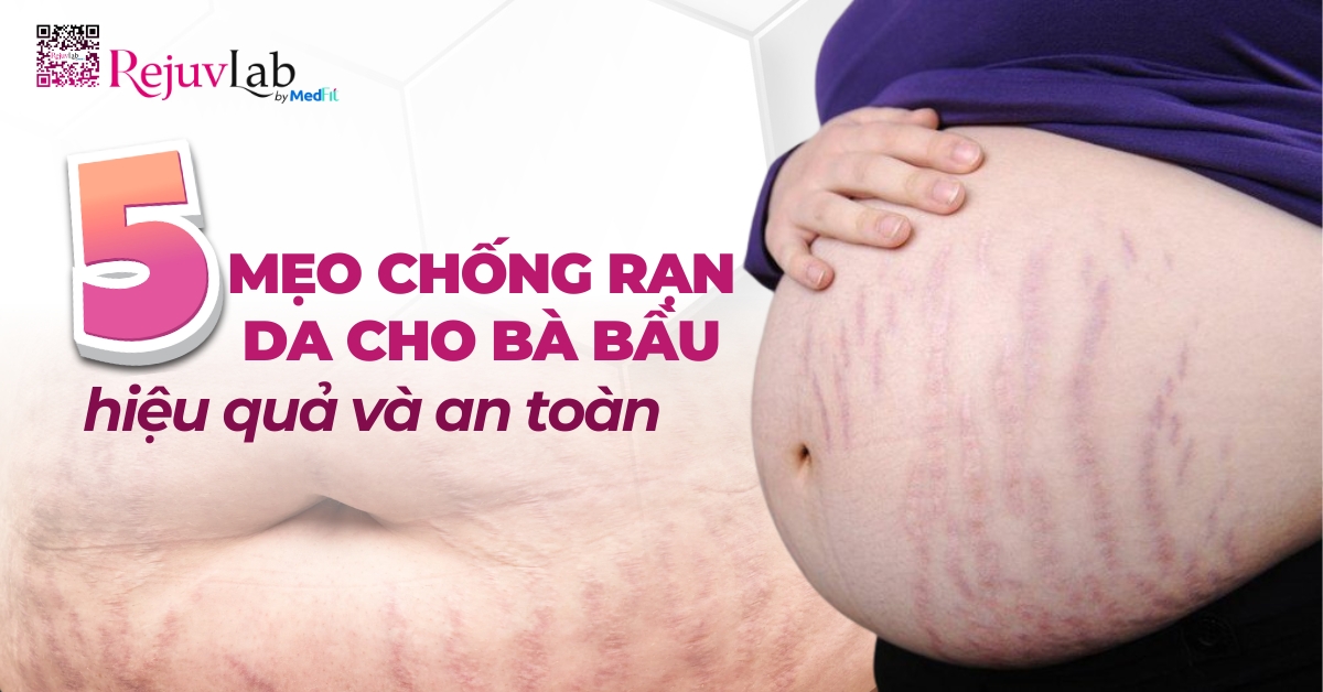 5 mẹo chống rạn da cho bà bầu hiệu quả và an toàn