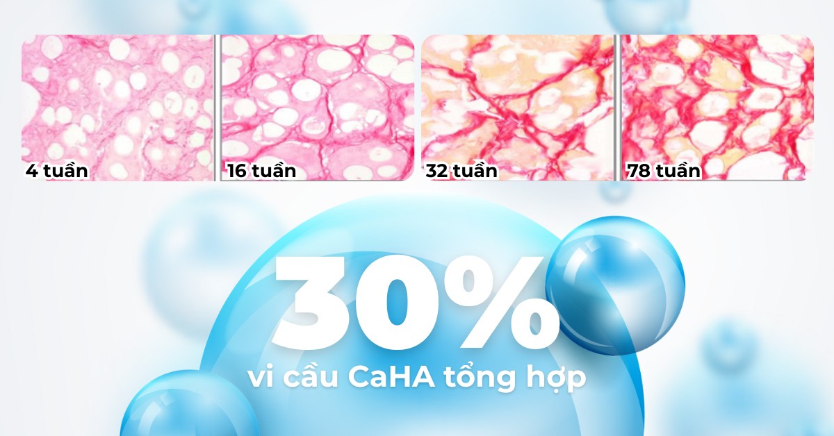 Tăng sinh collagen