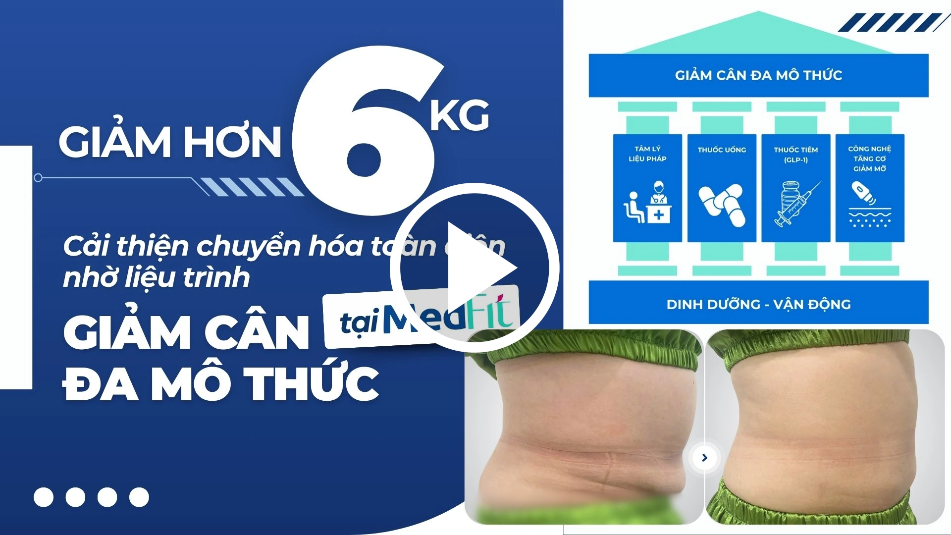 Thumb clip giảm cân Medfit Giảm 6 kg