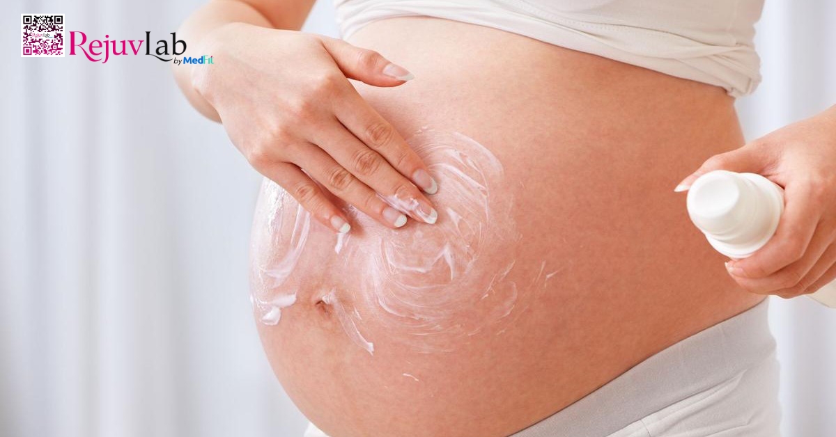 bôi chống rạn da cho bà bầu
