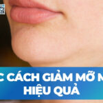 Các cách giảm mỡ mặt hiệu quả
