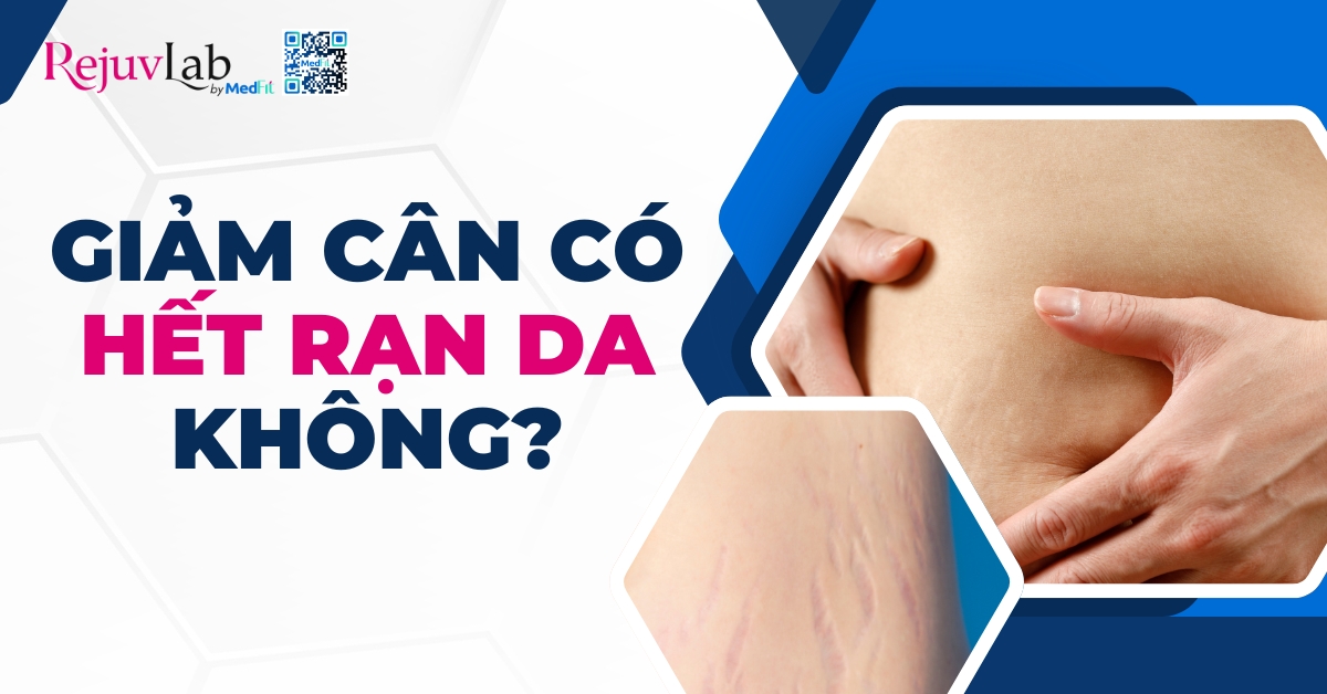 giảm cân có hết rạn da không