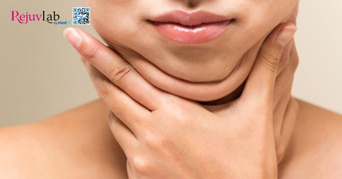 Các cách giảm mỡ mặt hiệu quả 1 hình minh hoạ mỡ mặt