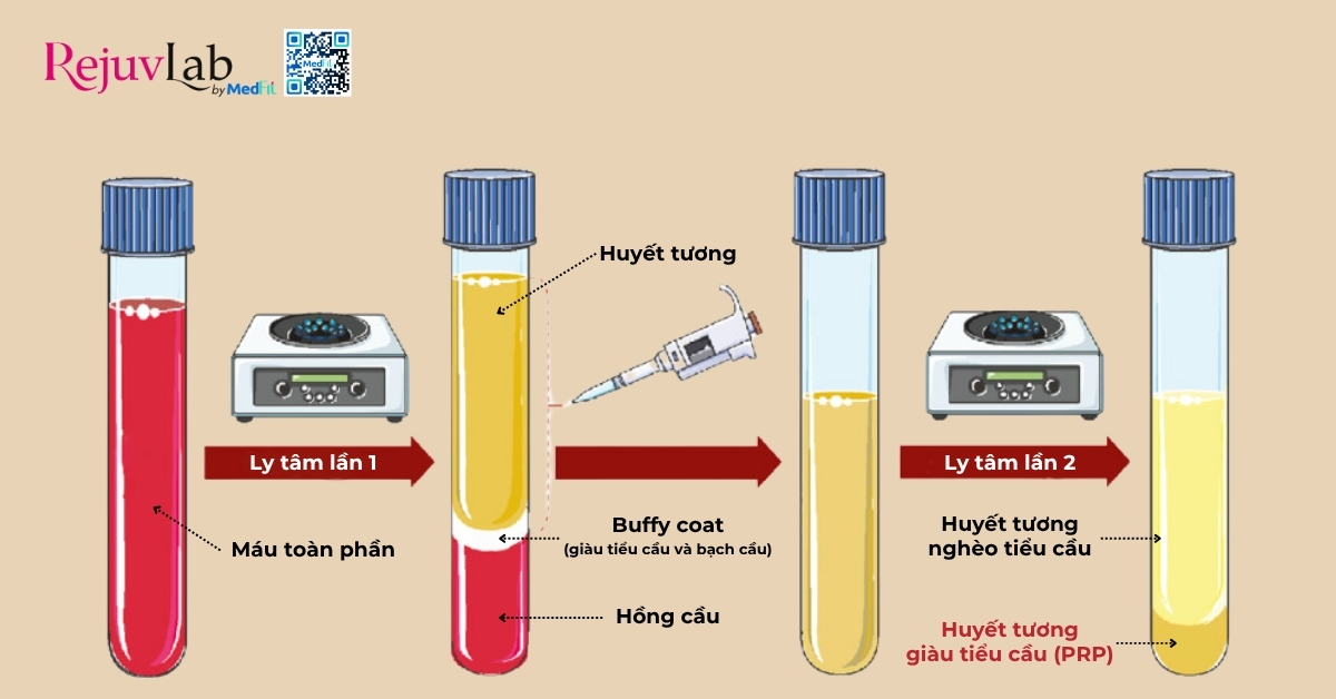 hình minh họa phương pháp lấy máu tự thân để tiêm prp