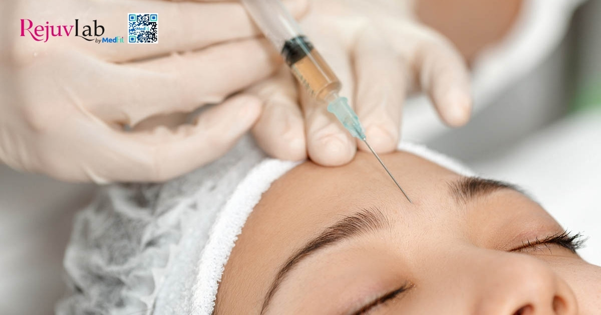 Tất cả những gì bạn cần biết về skin booster trong trẻ hóa và tái tạo làn da 15 hình minh họa tiêm botulinum toxin