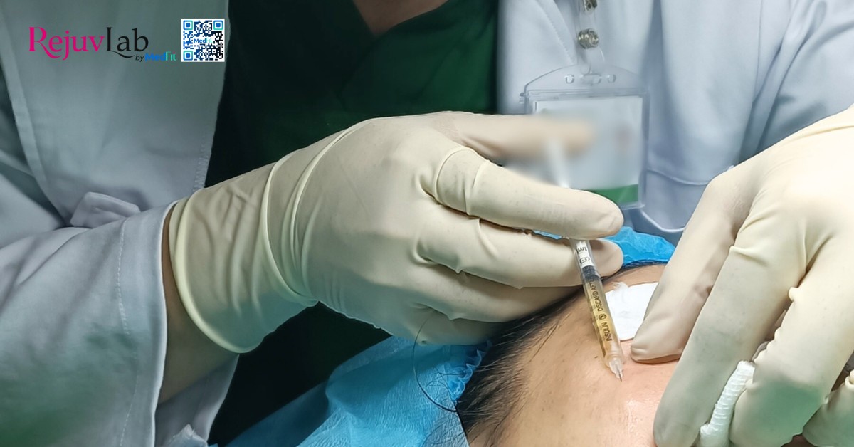 Tất cả những gì bạn cần biết về skin booster trong trẻ hóa và tái tạo làn da 18 hình minh họa tiêm prp