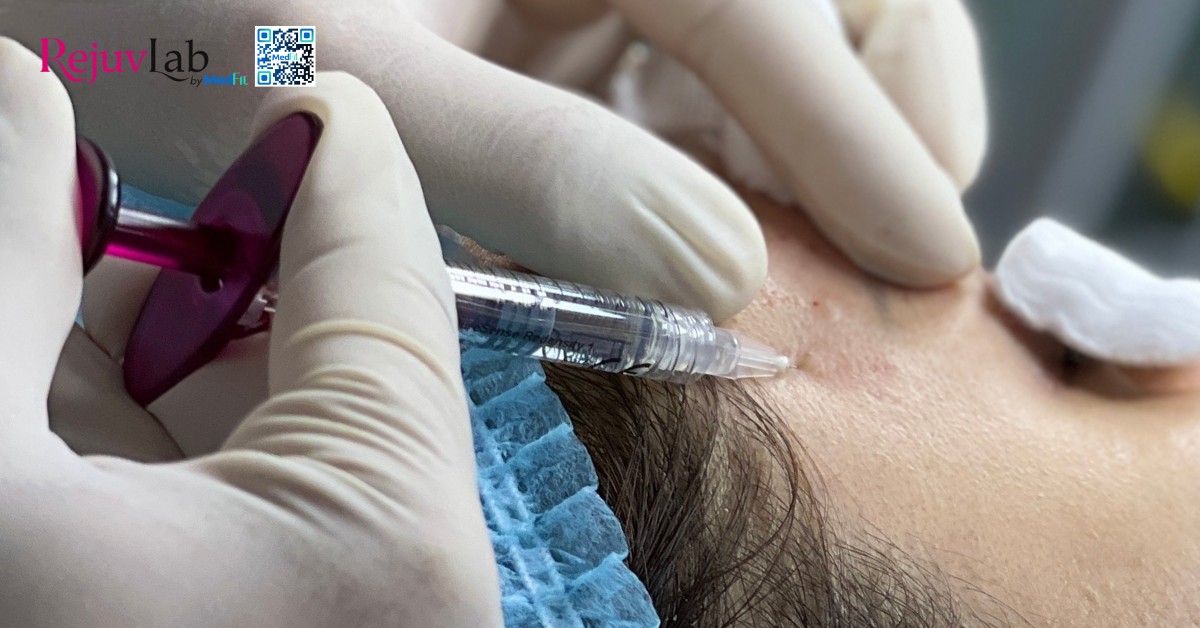 Tất cả những gì bạn cần biết về skin booster trong trẻ hóa và tái tạo làn da 1 hình minh họa tiêm skin booster
