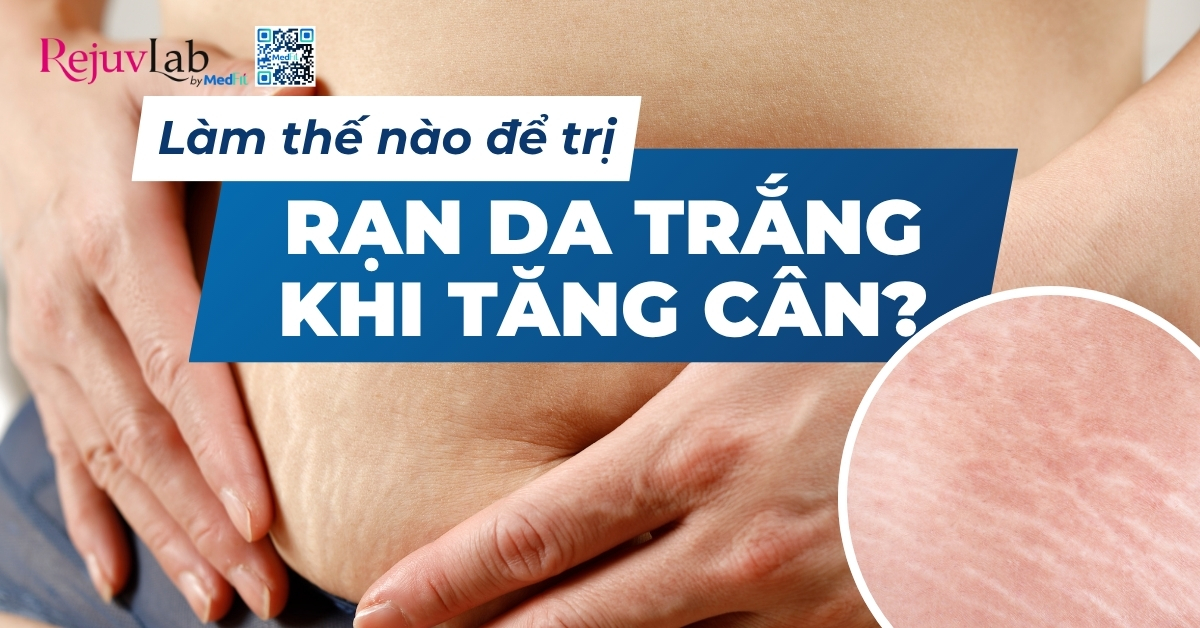 làm thế nào để trị rạn da trắng khi tăng cân
