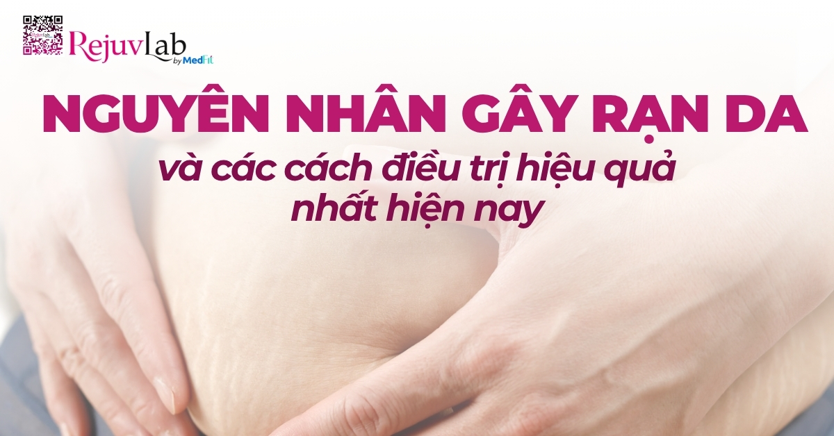 nguyên nhân gây rạn da và các cách điều trị hiệu quả nhất hiện nay