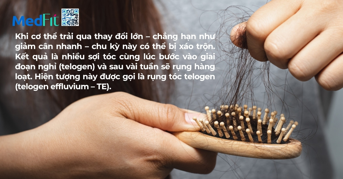 nguyên nhân gây rụng tóc khi giảm cân