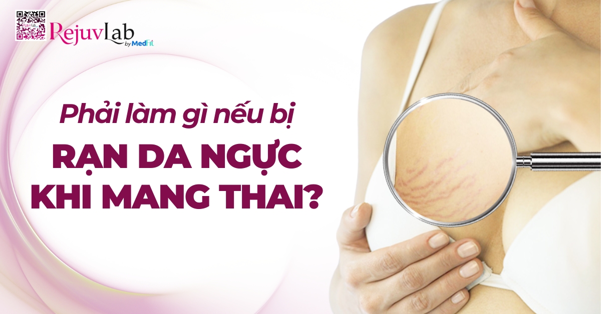 phải làm gì nếu bị rạn da ngực khi mang thai