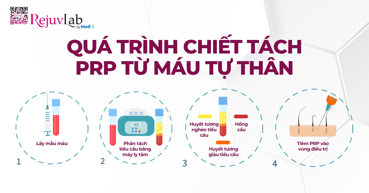 quy trình chiết tách prp