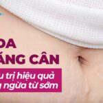 Bị rạn da đỏ có thể tự hết không? 5 Rạn da do tăng cân: Cách điều trị hiệu quả và phòng ngừa từ sớm
