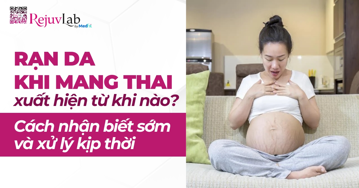 rạn da khi mang thai xuất hiện khi nào