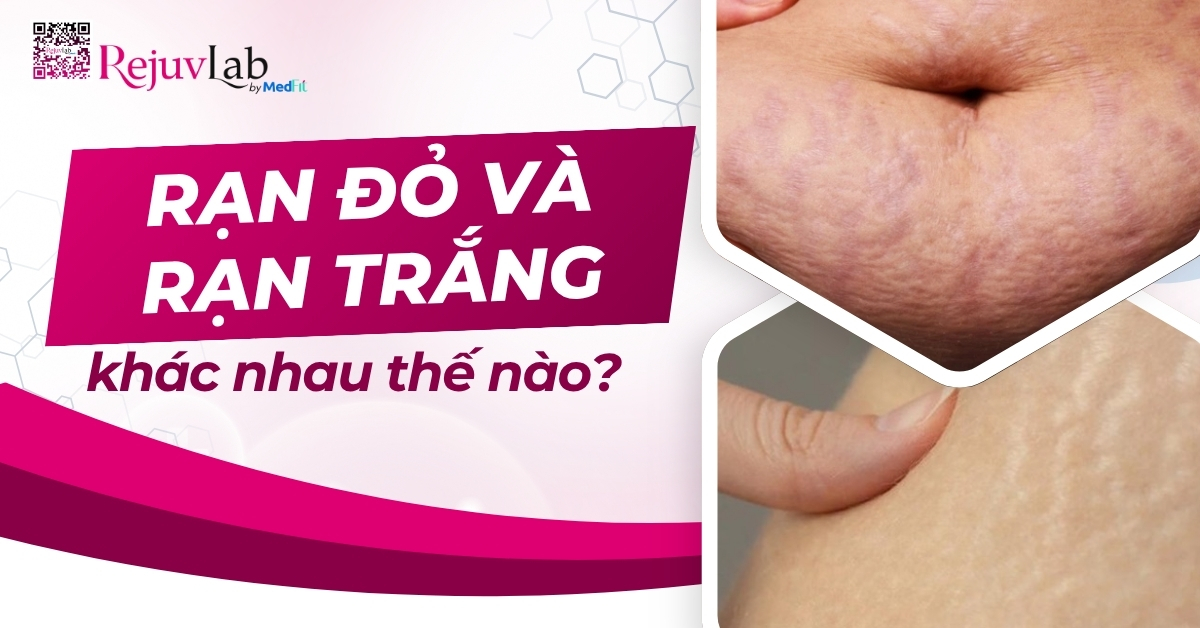 rạn đỏ và rạn trắng khác nhau thế nào