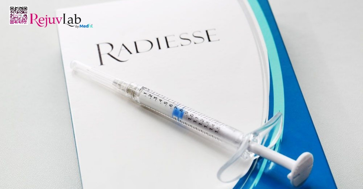 sản phẩm radiesse