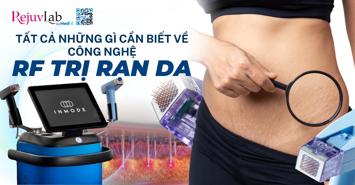 tất cả những gì cần biết về công nghệ rf trị rạn da