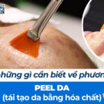 Tất cả những gì cần biết về phương pháp peel da (tái tạo da bằng hóa chất)