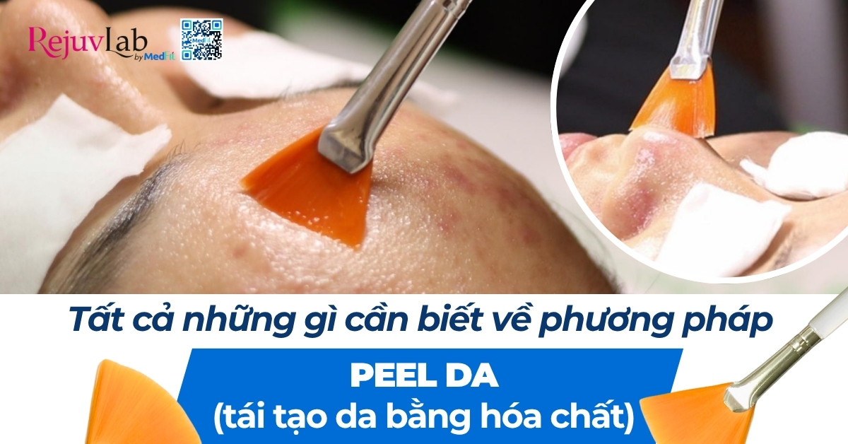 tất cả những gì cần biết về phương pháp peel da