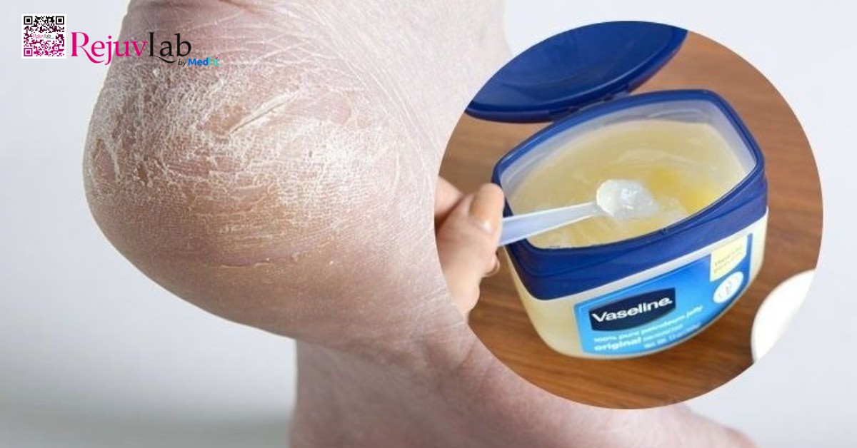 vaseline dưỡng ẩm và làm mềm gót chân