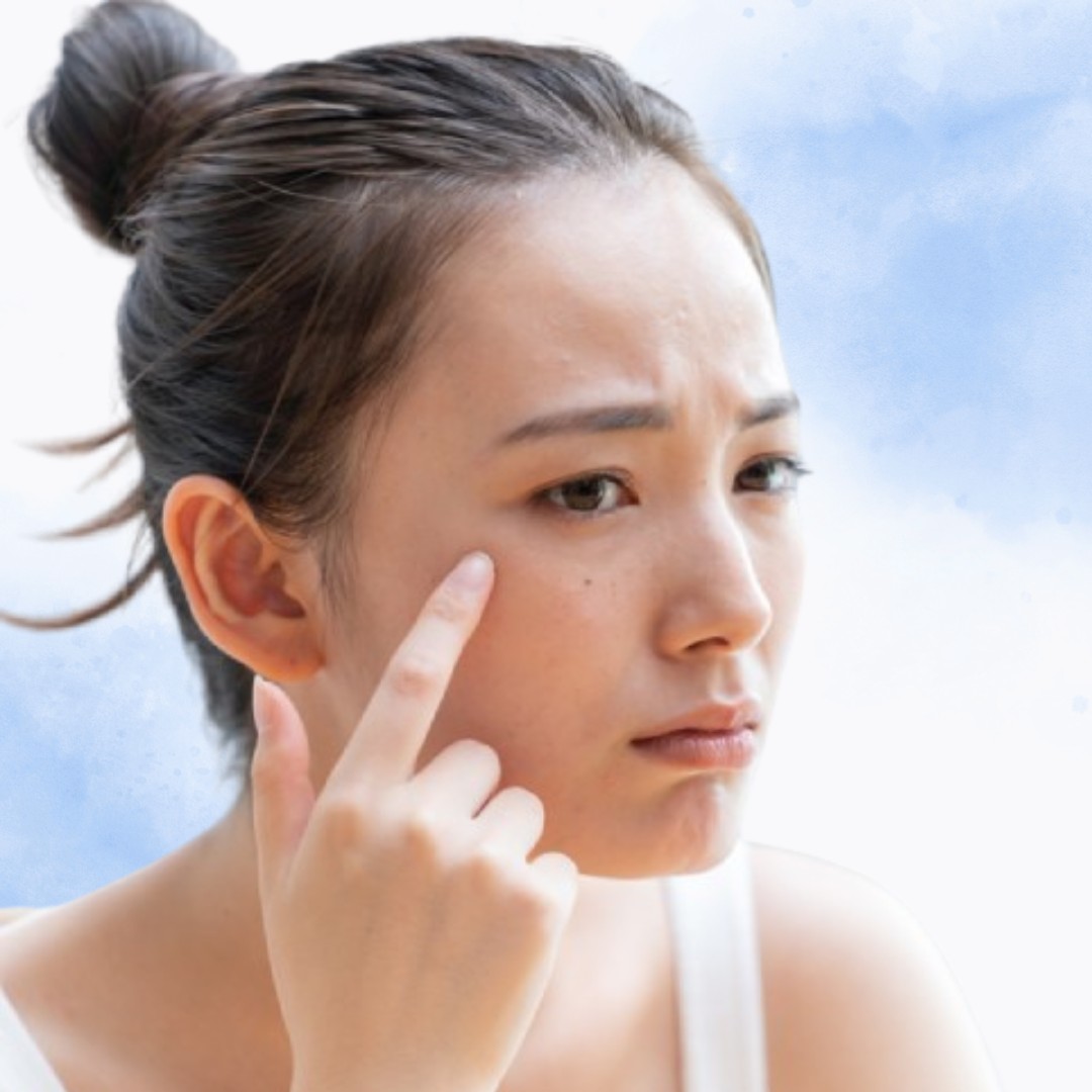 Da khô thiếu sức sống