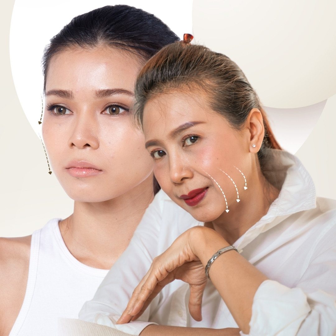 Mặt hóp - lão hóa