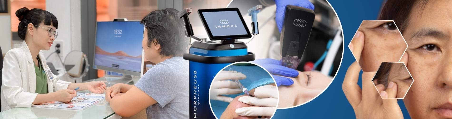 Vì sao nên trẻ hóa vùng mắt tại MF - PC