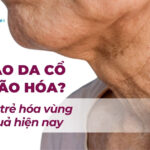 Tại sao da cổ dễ bị lão hóa? Các cách trẻ hóa vùng cổ hiệu quả hiện nay