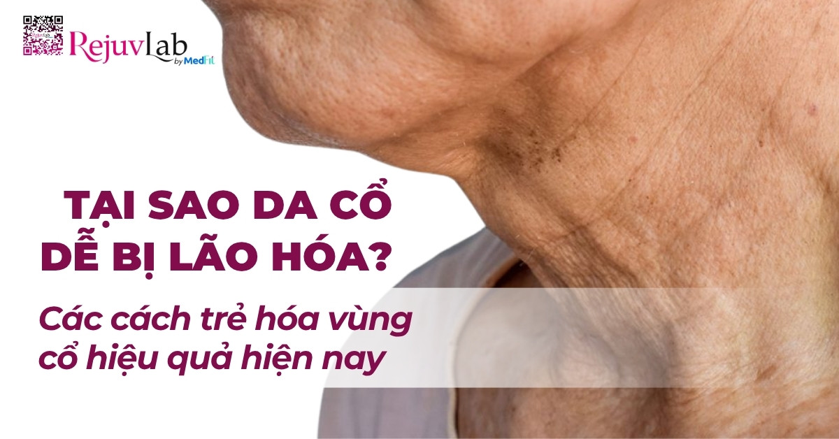các cách trẻ hóa vùng cổ hiệu quả hiện nay