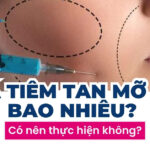 Giá tiêm tan mỡ má bao nhiêu? Có nên thực hiện không?