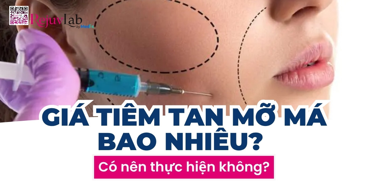 giá tiêm tan mỡ má bao nhiêu